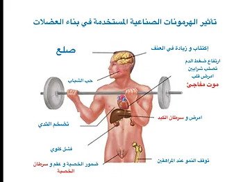 احذر هرمون بناء العضلات: سمٌّ قاتل يترافق مع 9 مضاعفات خطيرة