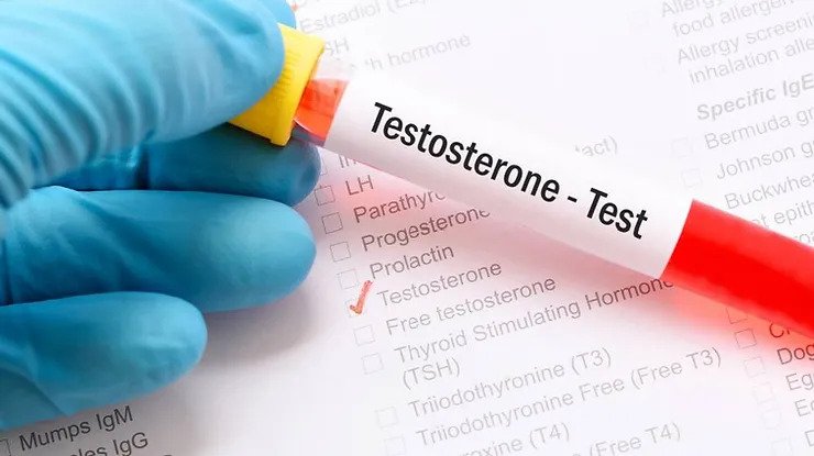 testosterone - test