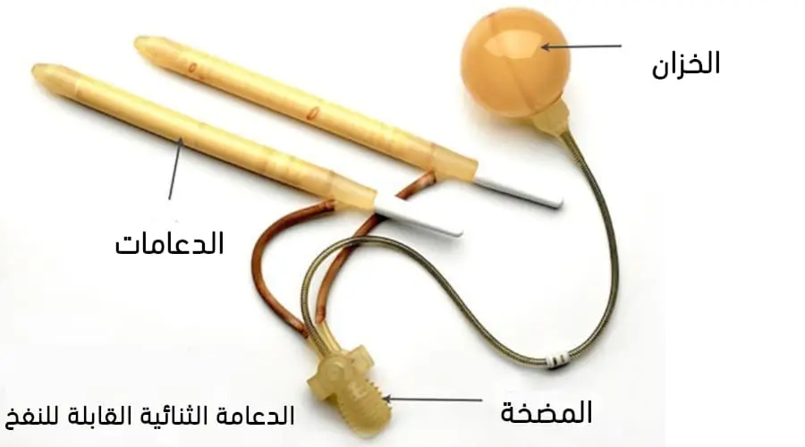 مميزات الدعامة الهيدروليكية: هل دعامة القضيب الهيدروليكية هي الحل الأمثل لعلاج ضعف الانتصاب؟